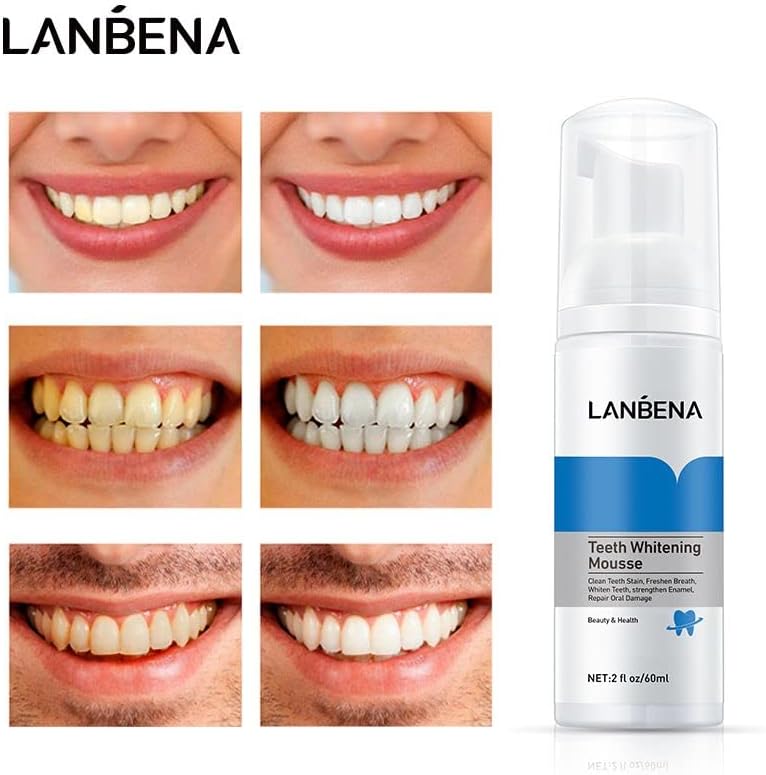 LANBENA Teeth Whitening Mousse 60ml