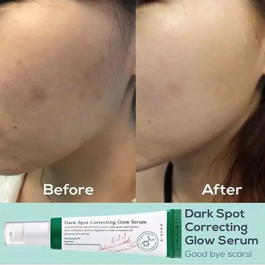 Axis Y Dark Spot Correcting Glow Serum